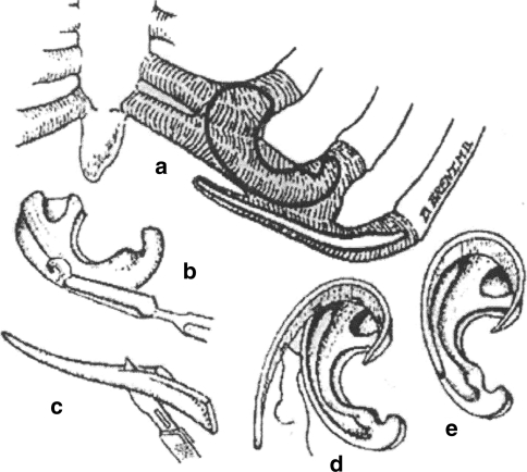 Fig. 3