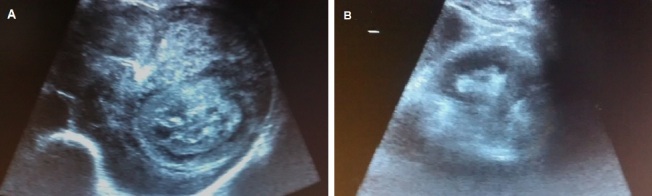 [Table/Fig-4a,b]: