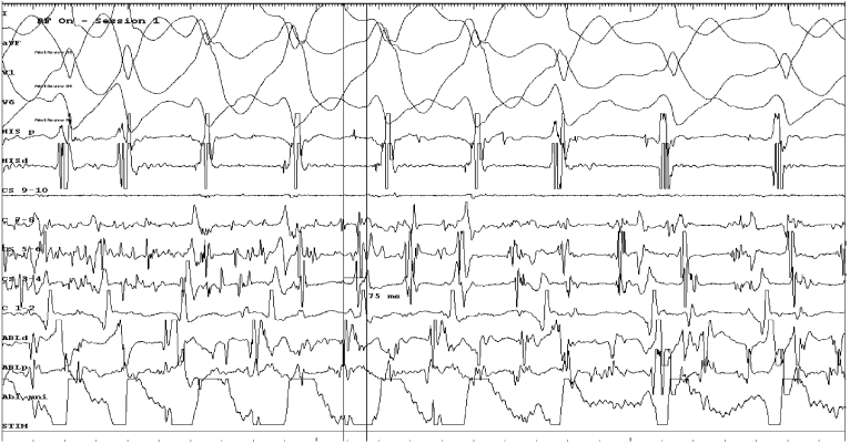 Fig. 1