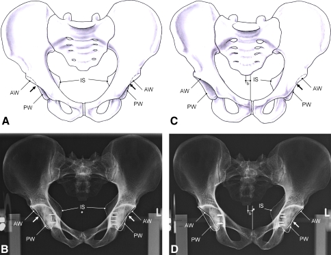 Fig. 2A–D