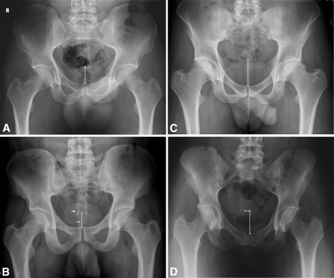 Fig. 5A–D