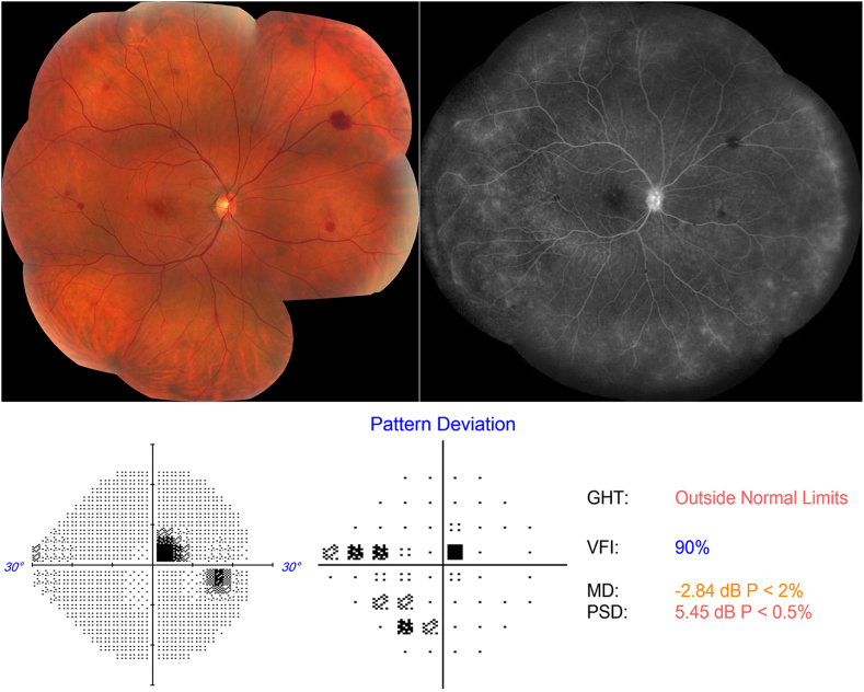 Fig. 1