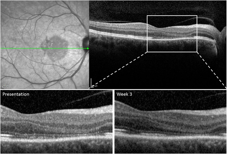 Fig. 2