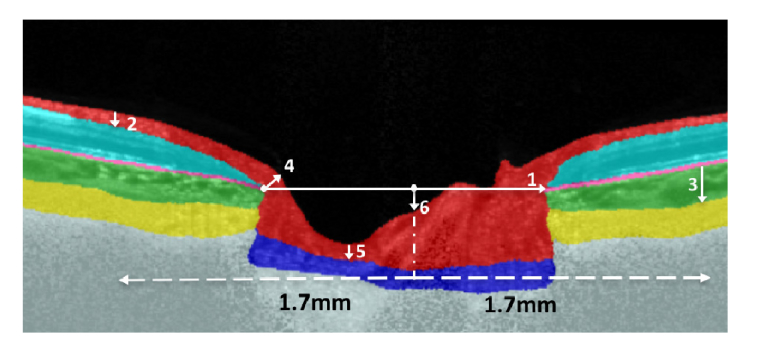 Fig. 4