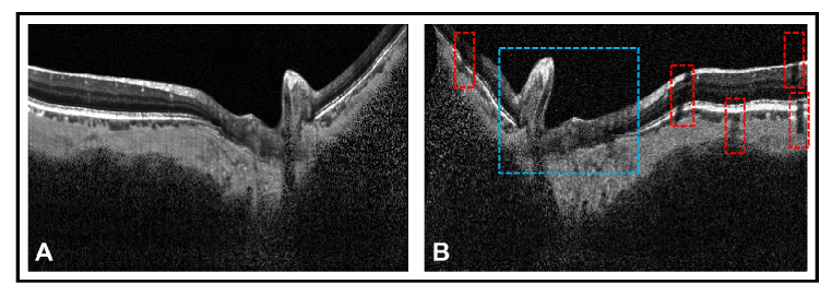 Fig. 3