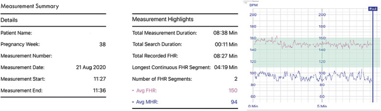 Fig. 2.