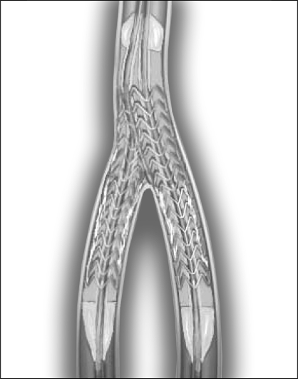 Figure 2)