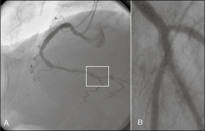 Figure 4)