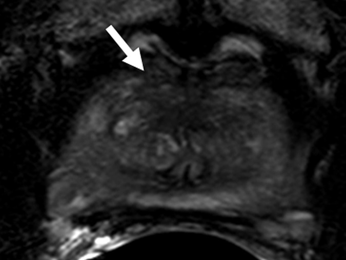 Figure 5a: