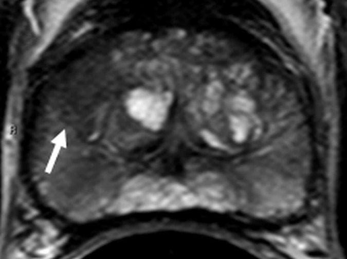 Figure 4a: