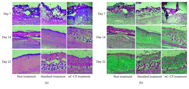 Figure 11