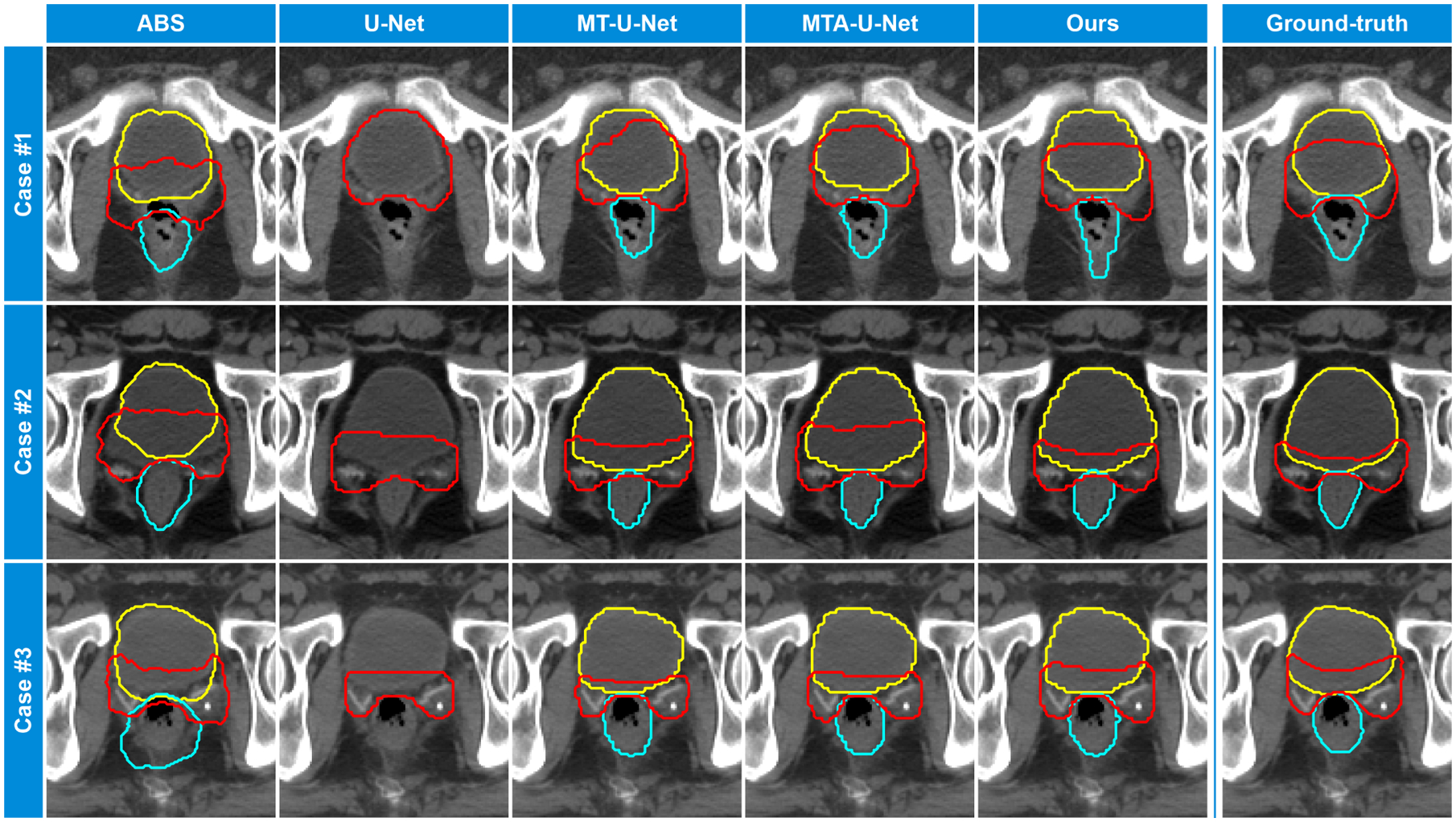 Fig. 4: