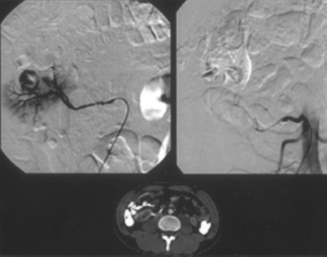 Fig. 3B
