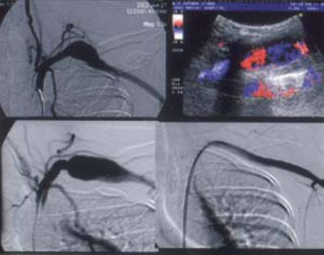 Fig. 2B