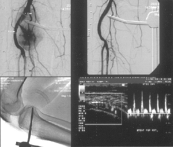 Fig. 4B