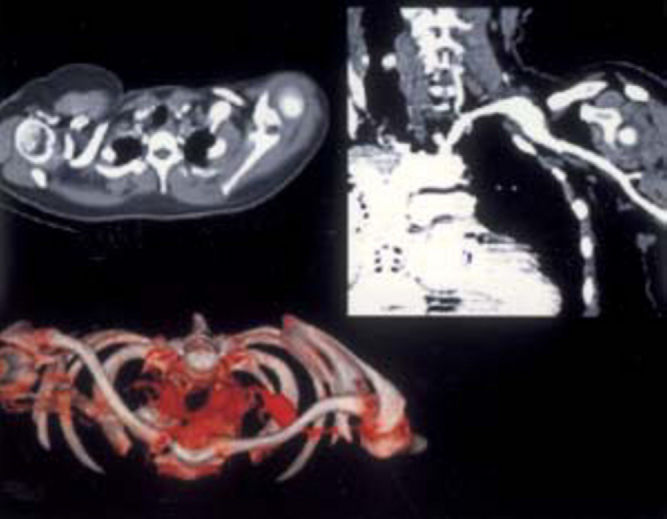 Fig. 2A