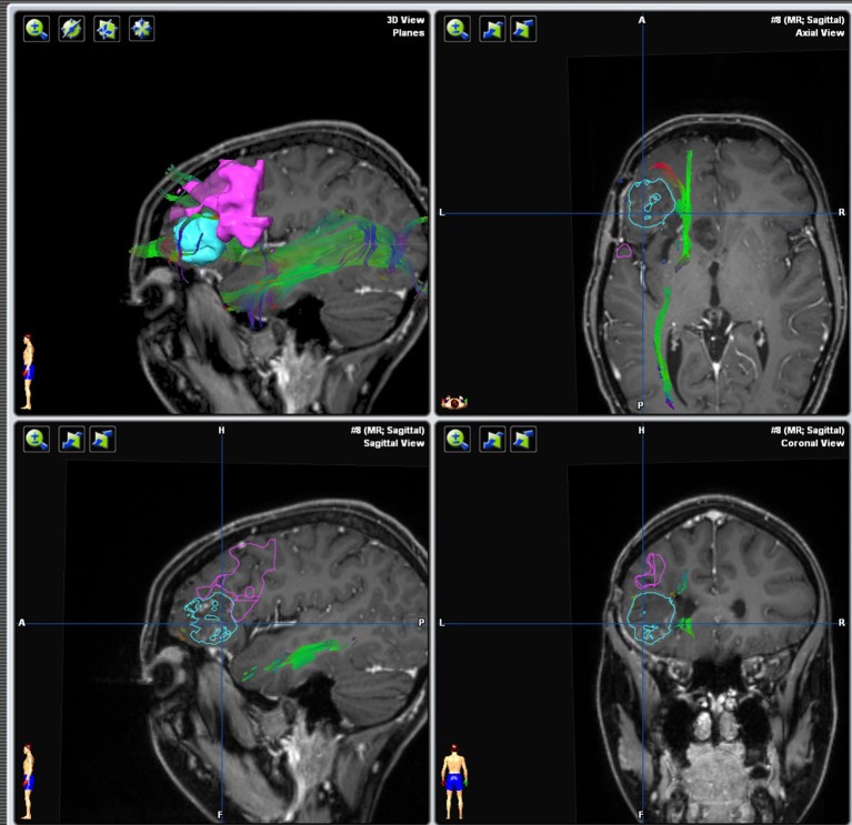 Figure 16