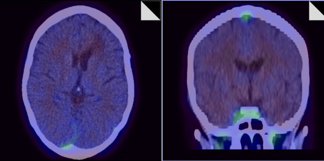 Figure 15