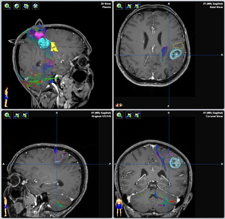 Figure 13