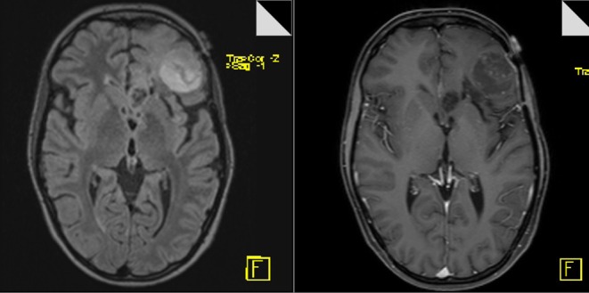 Figure 14