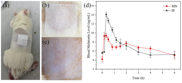 Figure 11