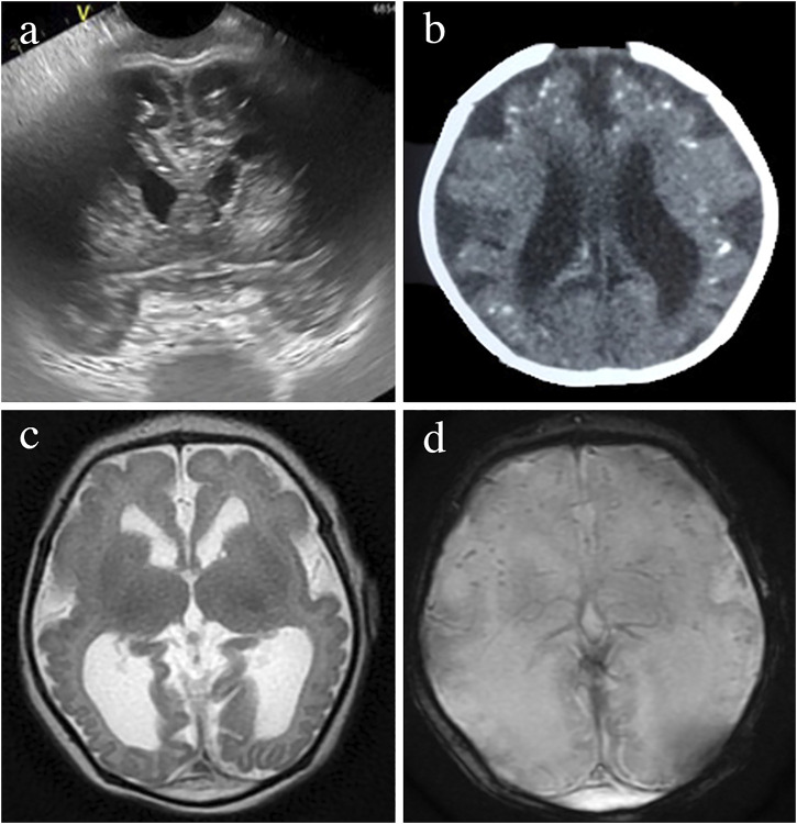 FIGURE 3