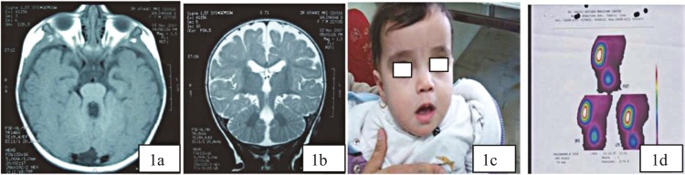 Fig1(a, b,c,d).