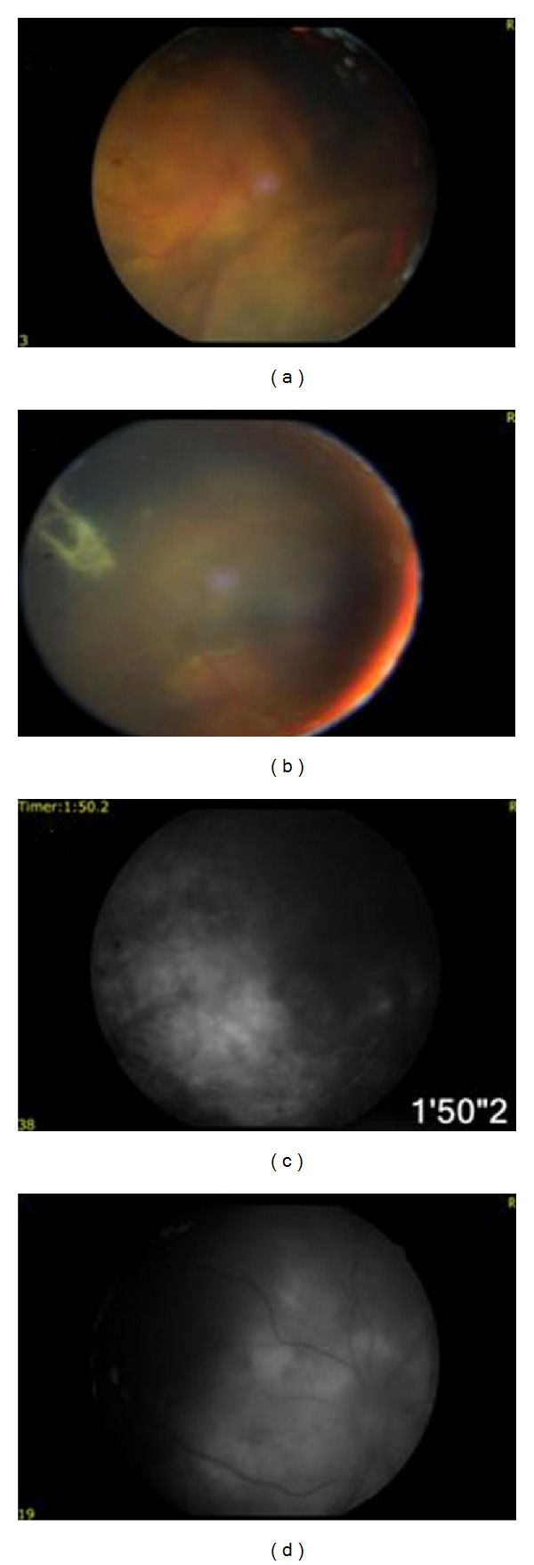 Figure 4