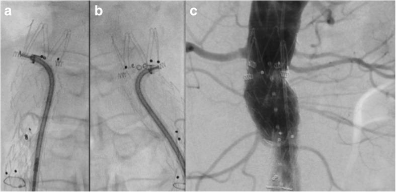 Fig. 2