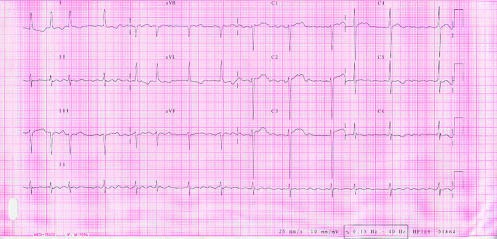 Fig 3