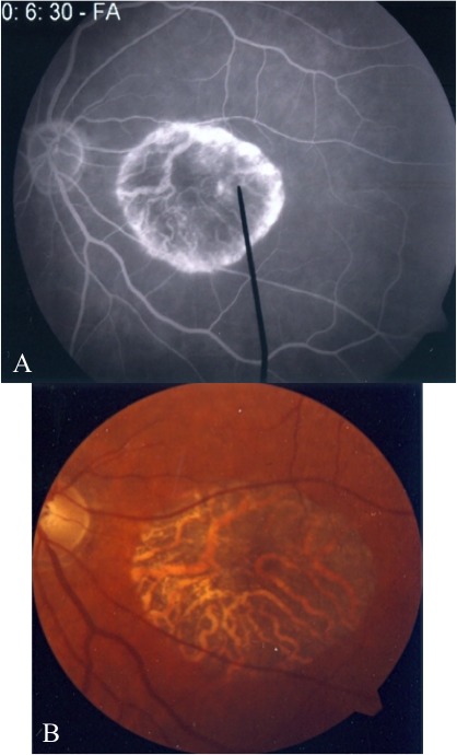 Figure 3. 