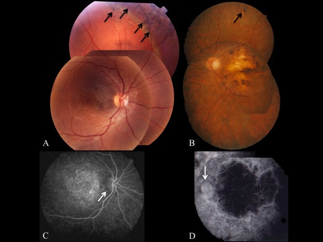 Figure 4. 