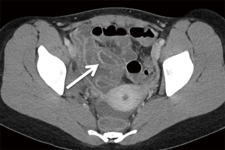 Figure 15