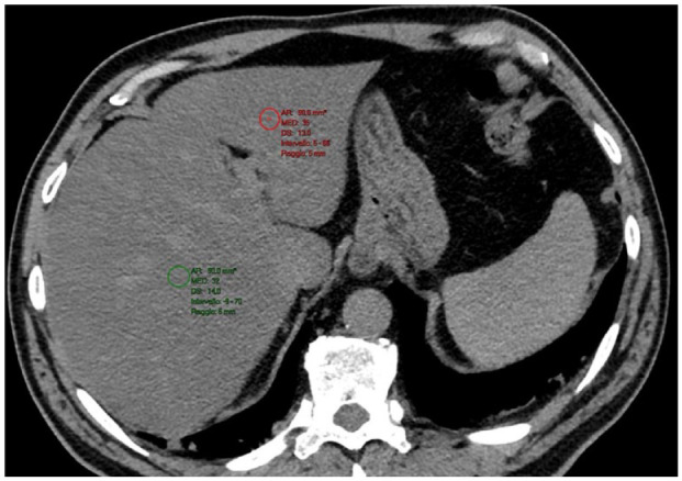 Figure 2.