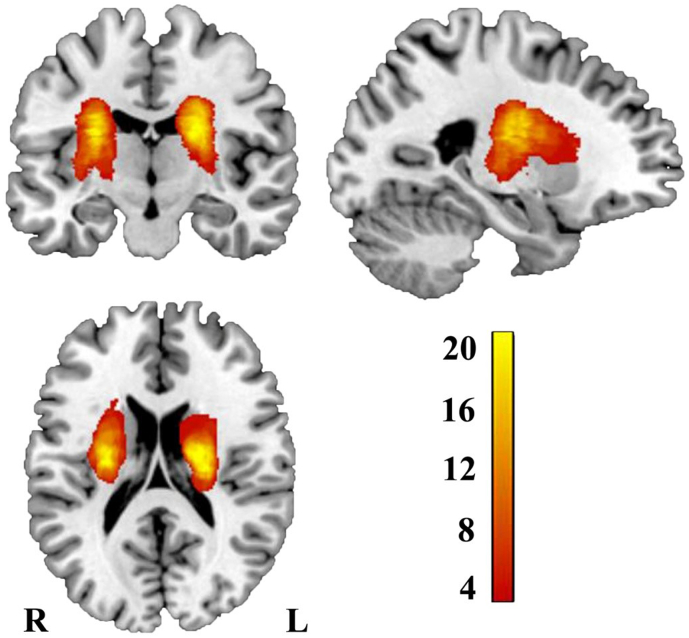 Fig. 1