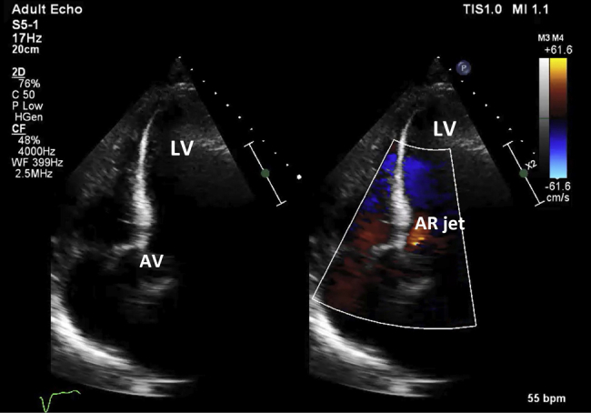 Figure 4