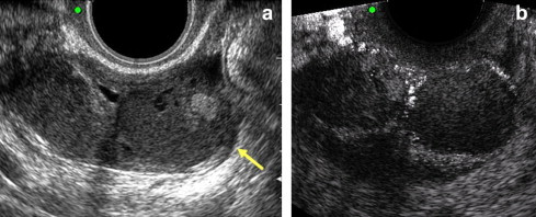 Fig. 3