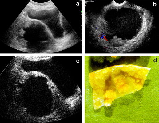 Fig. 4