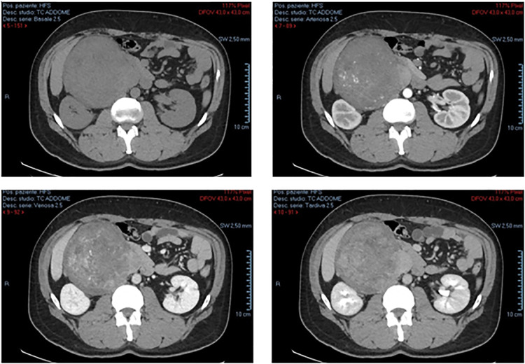 Fig. 2: