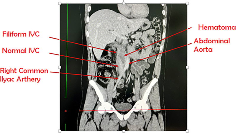 Fig. 4: