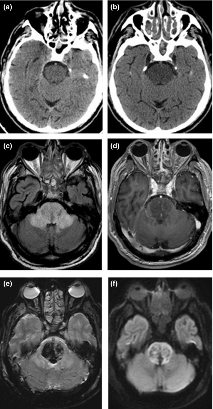 FIGURE 1