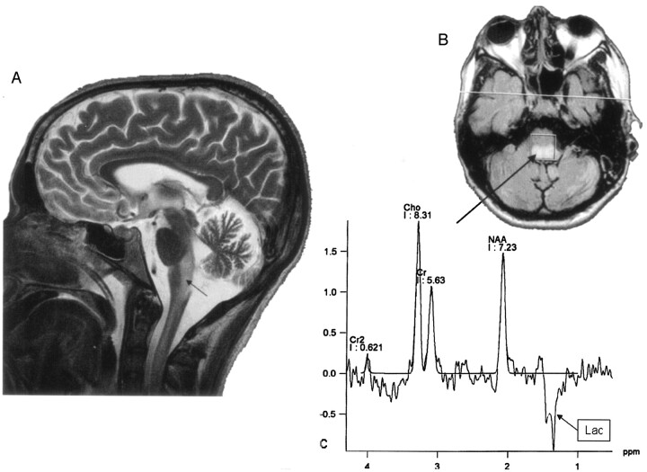 Fig 4.