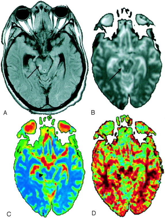 Fig 1.