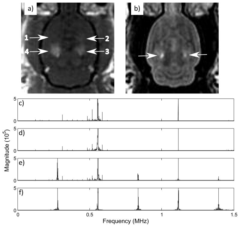 Fig. 13