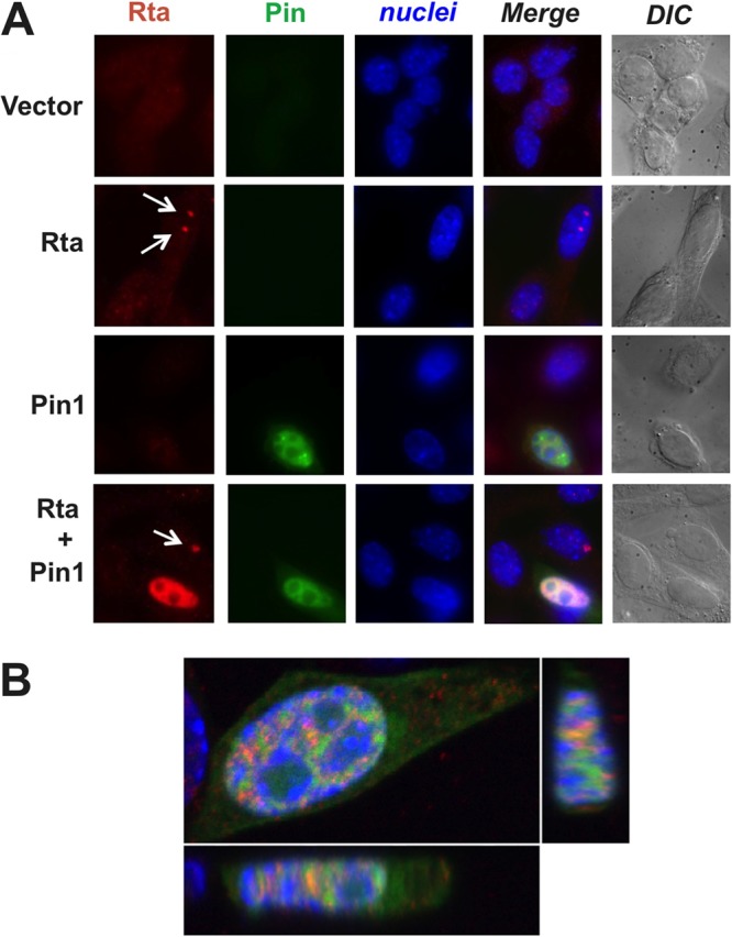 FIG 3