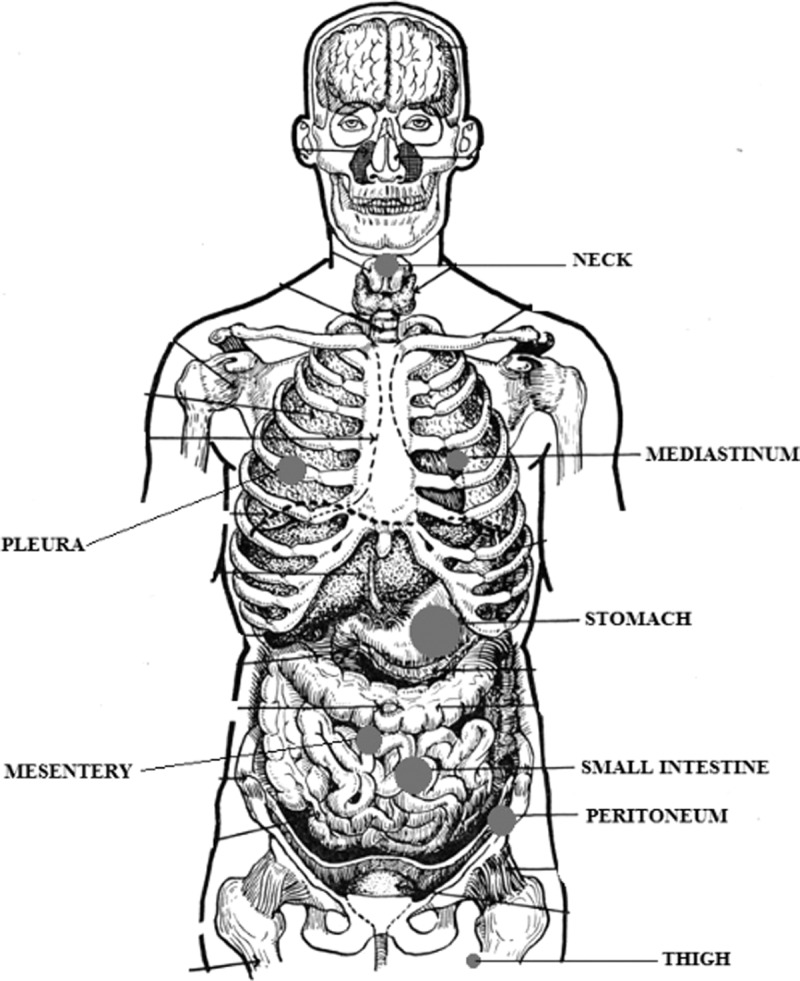 FIGURE 3