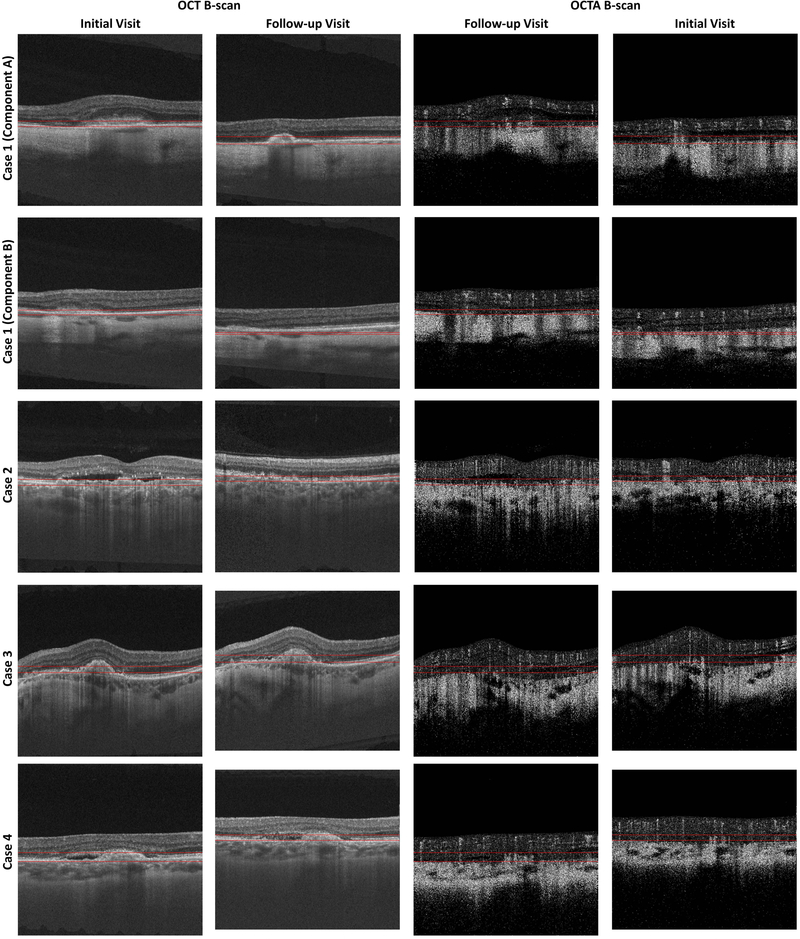 Figure 2A: