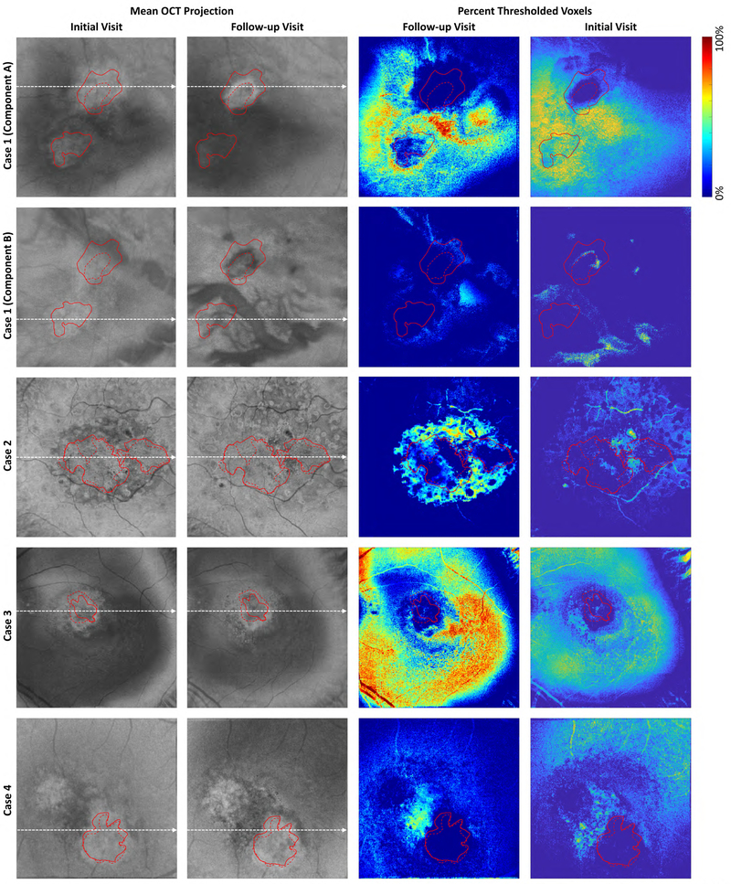 Figure 10A: