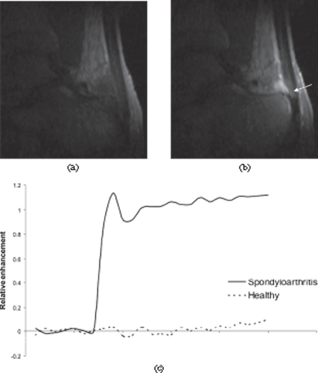 Figure 22