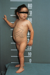 graphic file with name 978-3-662-57295-5_3_Fig7_HTML.jpg